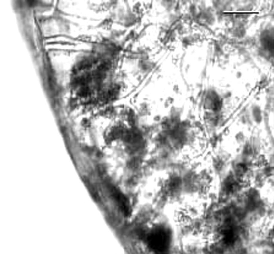 (83,2) 196,65 (457,6) (DS = 131,67) µm de ancho.