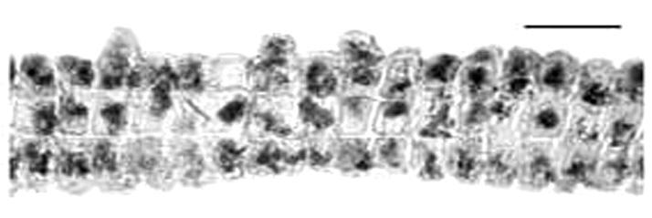 Según Allender & Kraft (1983), el carácter de separación entre éstas se basa en el número de capas celulares, Padina gymnospora presenta de tres a seis capas de células, mientras que P.
