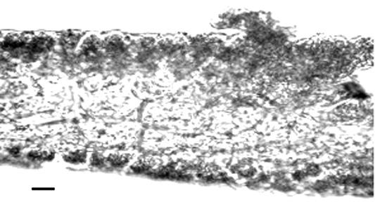 corteza formada por una capa de células cuadradas, rectangulares, pigmentadas, de (12,3) 22 (69,71) (DS = 19,51) µm de ancho y (16,4) 30,8 (53,30) (DS = 12,4) µm de largo.
