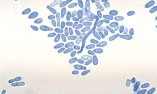 La levadura está presente en la flora cutánea, la cual pasa de la forma levuriforme a la micelial por factores predisponentes desconocidos, convirtiéndose así en patógena, aunque no siempre.