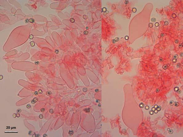CABALLERO MORENO, A. Fig. 15. Cistidios de Pluteus cyanopus. A la izquierda, queilocistidios, a la derecha, pleurocistidios. Foto: G. Muñoz. 8(-8,5) x (5,5-)6-7(-7,5) µm. Basidios tetraspóricos.
