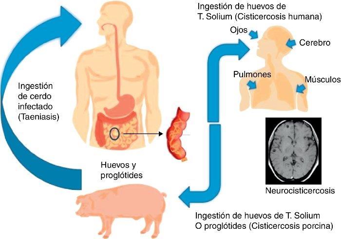 CESTODES CISTICERCOSIS: El cerdo puede estar parasitado por el metacestodo de Taenia hydatigena (Cysticercus tennuicollis), dando lugar a la cisticercosis visceral, o bien por el metacestodo de