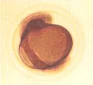 De 4 a 5 días se observa la formación del embrión, además de órganos