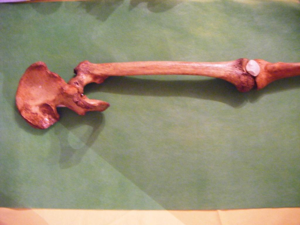 Fémur: ubicación Esqueleto del muslo Unido arriba al Coxal Porciones: a. Epífisis superior b.