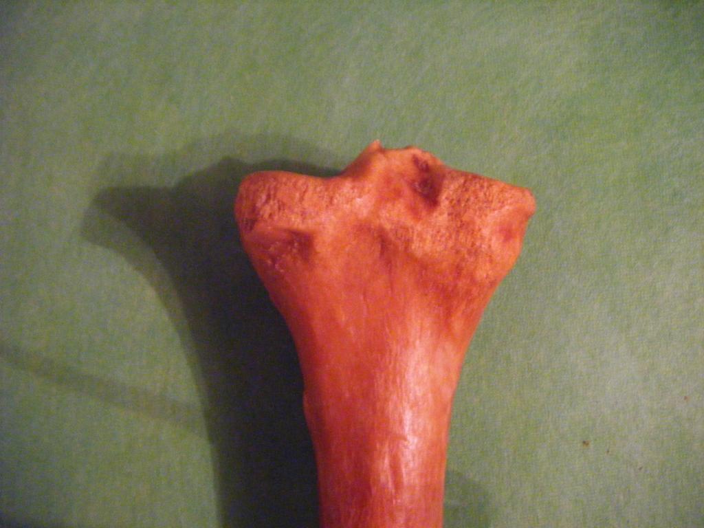 Tibia, epífisis superior, vista posterior 1. Eminencia intercondilar (espina Sbial) 2.