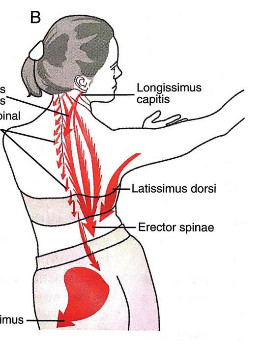 función muscular columna vertebral PLANO FRONTAL A través de su inserción sobre la fascia toracolumbar afecta a los distintos ejes anteroposteriores de la columna vertebral.