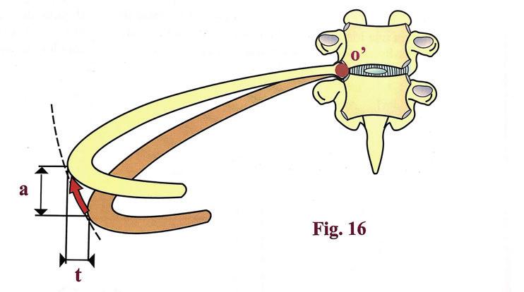 Un ejemplo podría ser un deltoides fibras medias, que en posición neutral podría provocar un desplazamiento superior de la cabeza del húmero respecto a la glena.