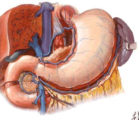El estómago es la porción más dilatada del tubo digestivo,