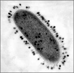 Virus Slide 93 / 111 Los pequeños puntos que están rodeando a la célula de la bacteria son virus que están infectando a su célula huésped.