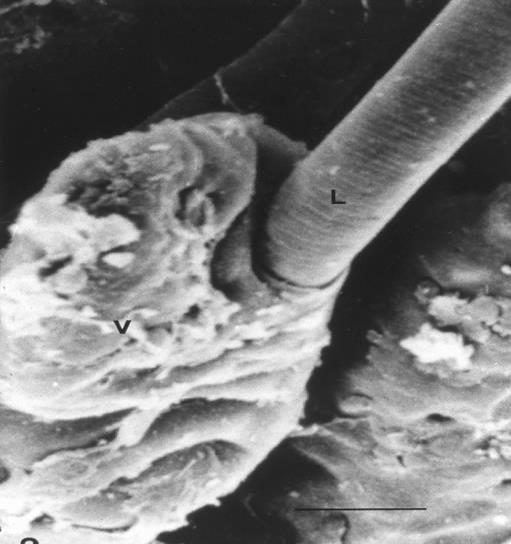 T spiralis: Modificación de células enteroepiteliales Invasión de células del epitelio columnar Invasión mucosa