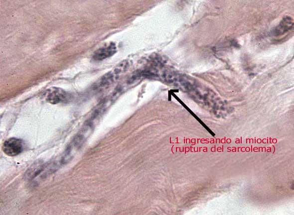 ingresando al miocito (ruptura del sarcolema)