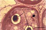 T spiralis: Formación de la cápsula Larva Día 7 pi Proteínas parasitarias Núcleo miocito Cápsula ARNm