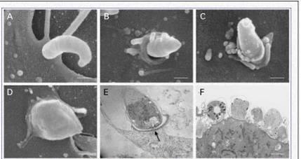 Crytosporidium spp: Invasión del enterocito A-Unión del esporozoito a la superficie