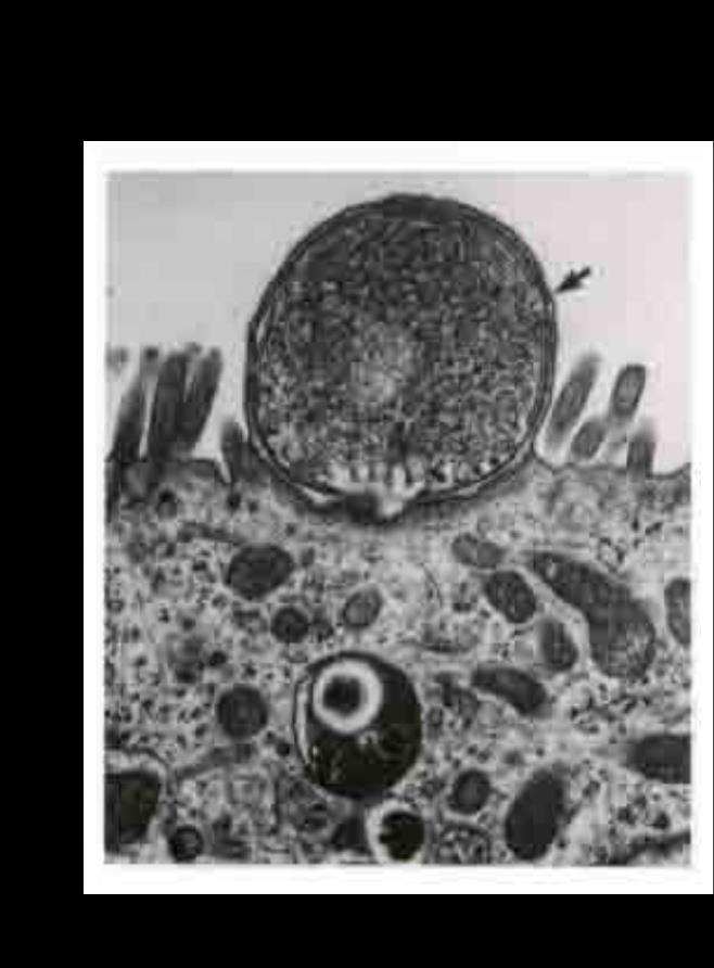 plasmática del enterocito alrededor del esporozoito Membrana plasmática del