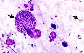 óxido nítrico Inmunidad celular (IFN-gamma) Infección aguda