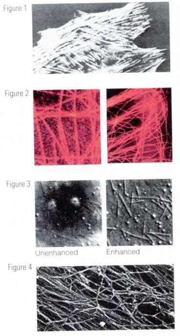 Microscopia de Inmunofluorescencia Técnicas de fluorescencia in vivo.