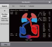 paciente. Además, gracias la tecnología de monitoreo de presión sanguínea ambulatoria más reciente de Mindray, los reportes de análisis ABPM pueden ser revisados e impresos.