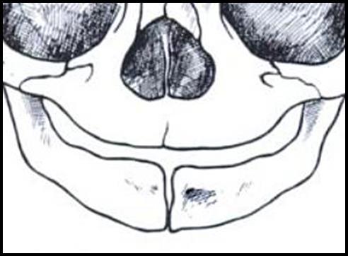 mandíbula hacia delante y abajo (crecimiento en el plano sagital y vertical). Fig.6: Crecimiento del cóndilo mandibular Crecimiento sutural.