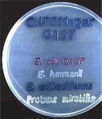 coli O157 por colonias coloreadas