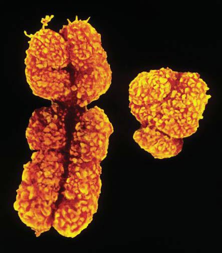 Como funciona la herencia los genes ligados al cromosoma X?