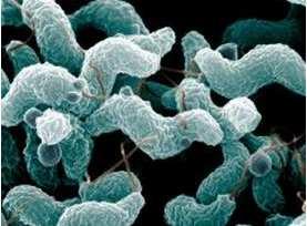 Campylobacter Es una de las principales causas de las enfermedades diarreicas de transmisión alimentaria del ser humano y la más comunes como causante de
