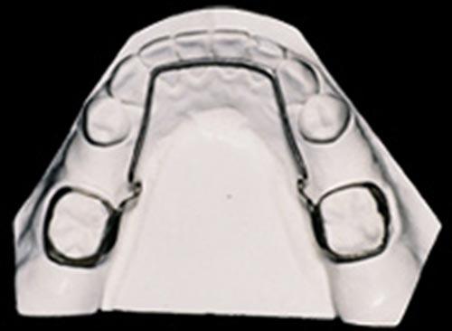 Página 2 molar inferior llega a la cavidad oral generalmente después que todos los dientes permanentes han hecho erupción; el segundo molar inferior erupciona típicamente antes que el segundo