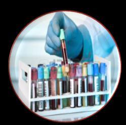 analizador de plomo en sangre LeadCare I Determinar la presencia de