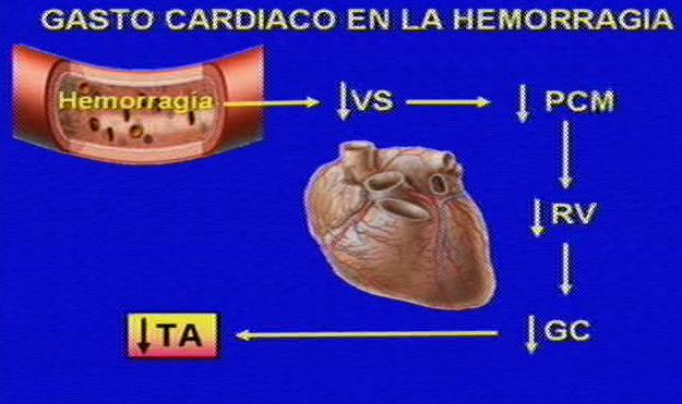 GASTO CARDIACO EN LA HEMORRAGIA Después de una hemorragia, se produce disminución del volumen sanguíneo, de la presión circulatoria media de llenado, del retorno venoso y del gasto cardiaco.