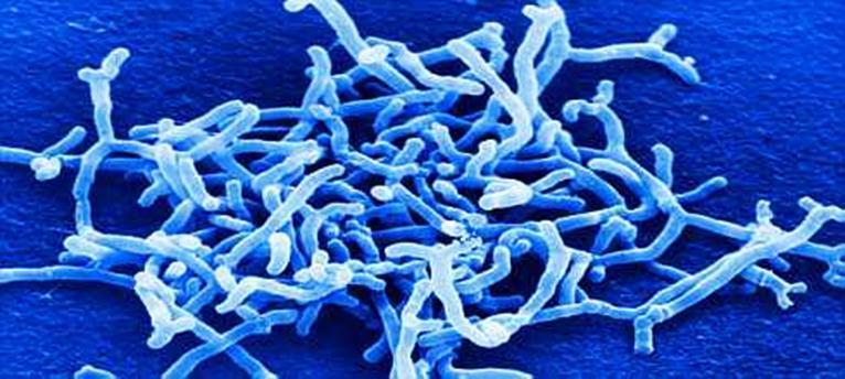 Bifidobacterium Bacteria gram positiva, anaeróbica, se encuentra en el colón de los humanos, genera los