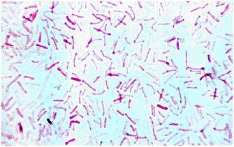 ETIOLOGÍA: Dichelobacter nodosus: Bacilo ligeramente incurvado 1 x 3-6 µ. Pili uni-polares (con botones bipolares). Patogenicidad relacionada a la presencia de pili. 9 serogupos (de la A a la I).