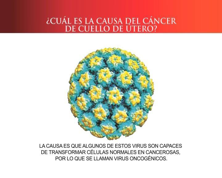 LA CAUSA ES UNA INFECCIÓN POR EL VIRUS HPV (PAPILOMA VIRUS HUMANO).