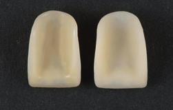 Acondicionamiento de los dientes Creopal y shells Creopal Es muy importante preparar correctamente la aplicación del primer.