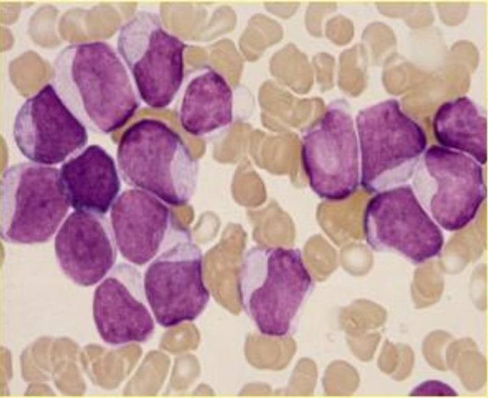 Clasificación morfológica L2 Rasgos citológicos Tamaño celular Cromatina Formas del núcleo