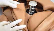 pulmones y corazón para una práctica realista de la maniobra de Heimlich Elevación de tórax realista durante la ventilación Puntos de pulso arterial carotídeo y femoral Punto de vena femoral Puntos
