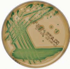 SR0228E Chromogenic Listeria Agar (ISO) Para especies de Listeria y Listeria monocytogenes; cumple los requisitos de fórmula recomendados en la norma ISO 11290-1:1997.