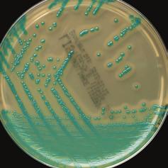 Brilliance Bacillus cereus Agar Base (medio de cultivo deshidratado) 500 g para 12,2 litros de medio CM1036B Brilliance Bacillus cereus Selective Supplement 10 viales para 500 ml de medio