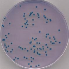 Chromogenic Coliform Agar (placas preparadas) 10 x 90 mm PO5318A 10 x 55 mm PO5428J Brilliance Listeria Agar Para el aislamiento, el recuento y la identificación de Listeria spp.