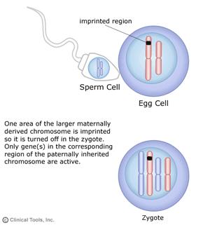 Impronta genética: puede ocurrir en cualquier cromosoma En la impronta, solo uno de los alelos de un gen se expresa activamente, ya que el otro se