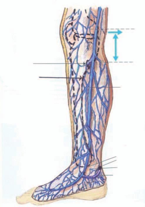 Línea interarticular de la rodilla Perforante postibial de Boyd Proyección del borde laterointerno de la tibia 10 cm Vena perforante Vena safena interna Safena