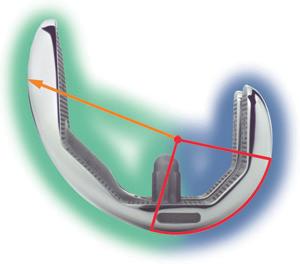 rodilla Componente femoral Adaptador de offset femoral/tibial Prominencia anterior levantada En contraste con los diseños de eje múltiple tradicional, el sistema de rodilla de eje único Scorpio