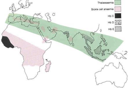 000 β-talasemia major 15.000 α-talasemia major (hydrops fetalis). ~ 70% en los países de bajos recursos.