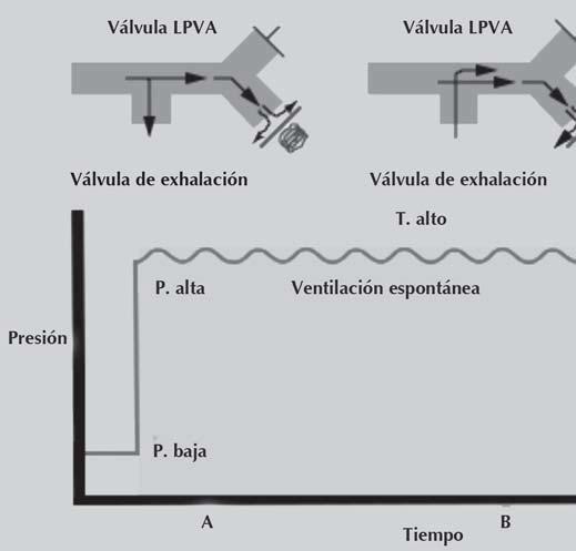 Rosado-Garduño P y col. Ventilación con liberación de presión de la vía aérea al permitir esfuerzos ventilatorios durante todo el ciclo respiratorio.