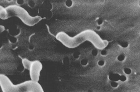 GENERO Campylobacter Bacilos Gram (-) Curvos, móviles Microaerofílicos 5-10%