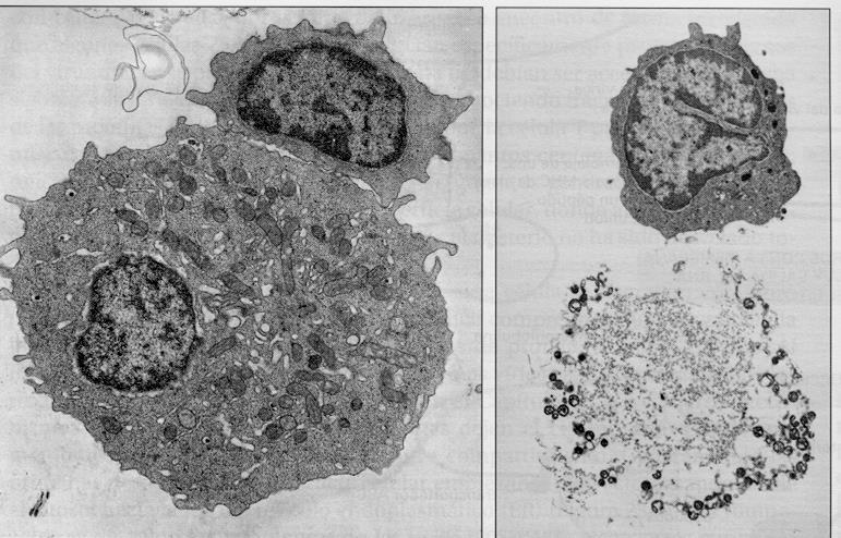 La apoptosis como mecanismo de eliminación de células infectadas