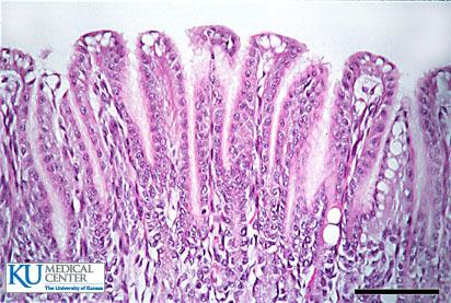 estómago sistema parasimpático delgado grueso boca estómago delgado