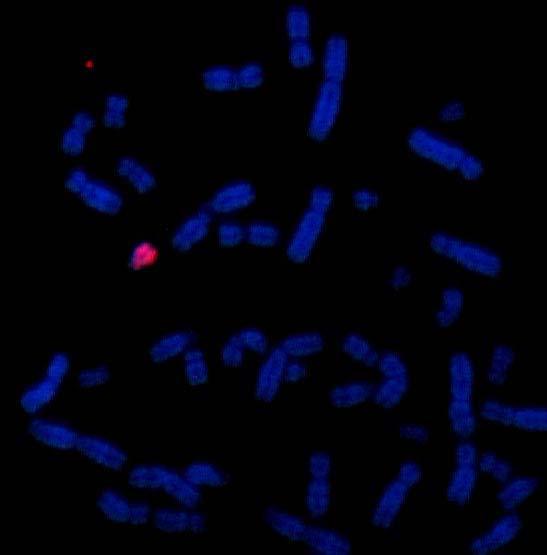 Sonda Pintado Cromosómico Total Y PCT Y Sonda de Pintado Cromosómico Total (PCT): Las sondas de pintado cromosómico total abarcan completamente el cromosoma blanco generando una señal