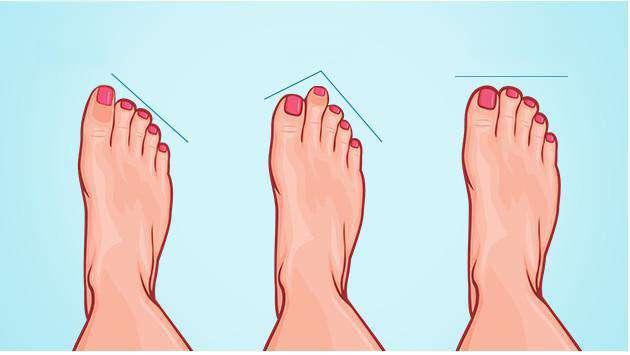 Tipos de pies / Types of feet De acuerdo con su tipo de pie, es el tipo de punta de su plantilla According to your type of foot is the tip type of