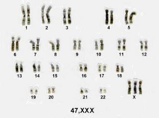 MUTACIONES CROMOSÓMICAS Cariotpo 47, XXX A pesar de tener tres cromosomas, se trata de mujeres bastante normales, pero