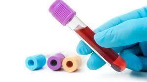 Analítica sanguínea Bioquímica: - Ionograma normal - Función renal y GPT normales - PCR 5 mg/dl - PCT 0.3 ng/ml Hemograma: - Hb 8.