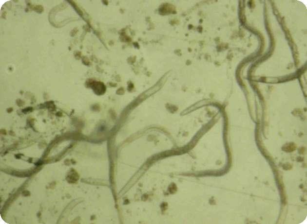 8. Uso de nematodos entomopatógenos. Los nematodos son organismos vivos y microscópicos, que se desarrollan en ambientes húmedos como el suelo.
